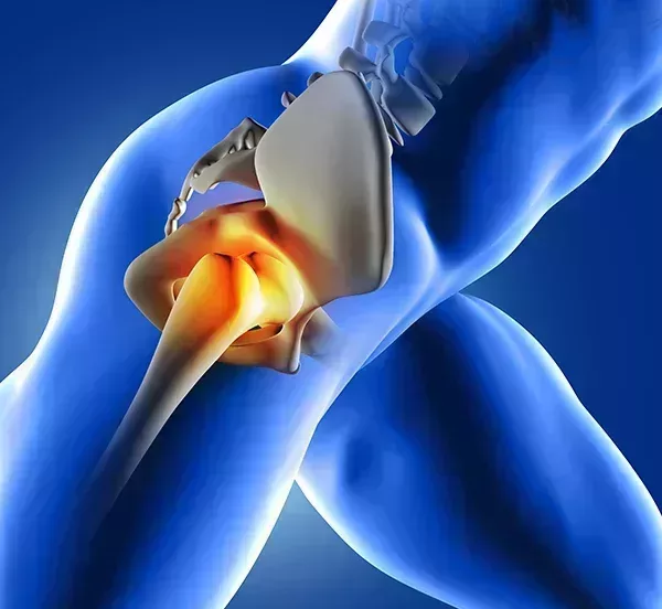 heupoperatie revalidatieprogramma